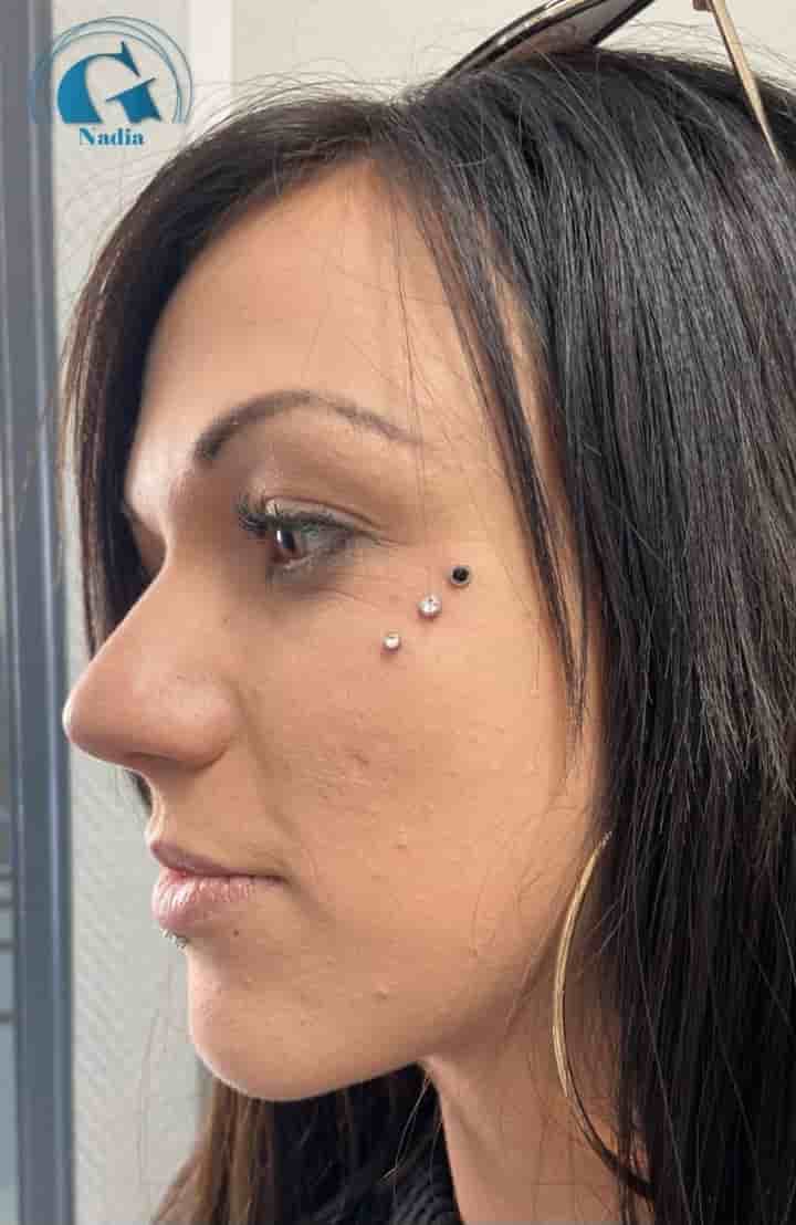 femme portant 3 microdermaux à la pommette